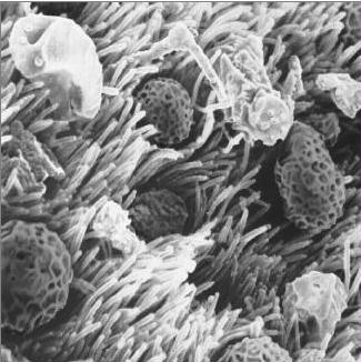 Irrigador Nasal Grossan