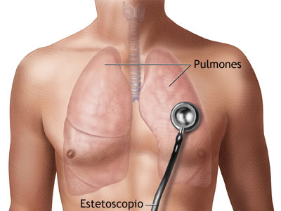 Disnea sibilante en adultos