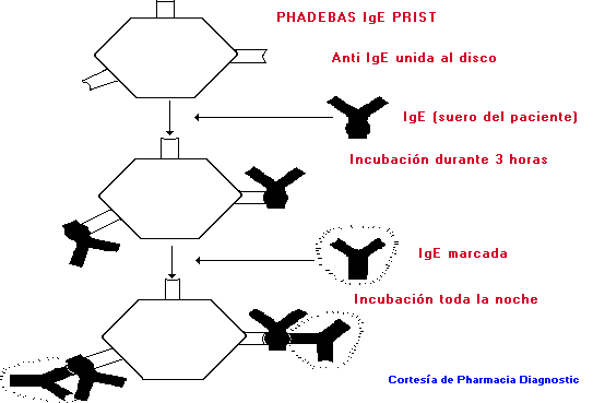 Tecnica de PRIST