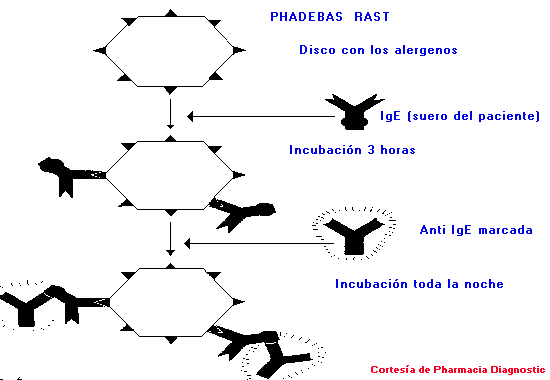 Técnica de RAST