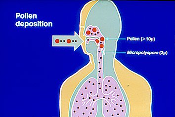 Deposito de Polen en Vias Aereas Inferiores