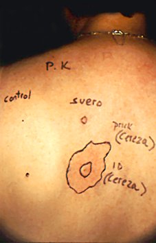 Prueba de transferencia pasiva